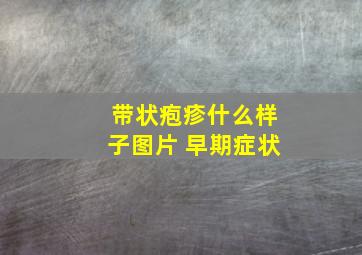 带状疱疹什么样子图片 早期症状